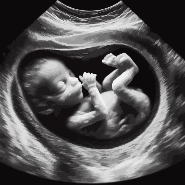 High res scan of a child in a womb